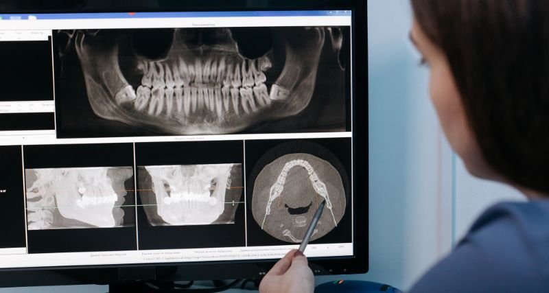 Curso de Odontología Restauradora Basados en Nuevas Tecnologías, Curso de Odontología Restauradora Basados en Nuevas Tecnologías, Odontología Restauradora, odontología, restauración de los dientes, desgaste dental, radiología digital, odontología, ISEIE, Institución Superior Estudios Innovadores Europeos, restauración dental, odontología restauradora, rehabilitación dental, profesionales de la odontología, Odontología Restauradora, Tejido Dental, Enfermedad Periodontal, Desgaste Dental, Forma de los Dientes, Rehabilitación Oral, Prótesis Dentales, Rehabilitación Oral Asistida por Ordenador, Radiología Digital, Restauraciones Dentales, Odontología Digital, Odontología Restauradora