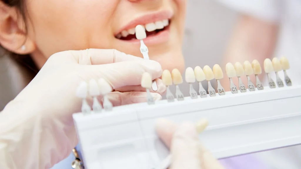 ISEIE-rehabilitación oral