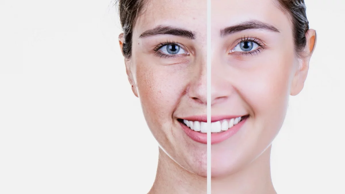 ISEIE-Dermatología y Antiaging