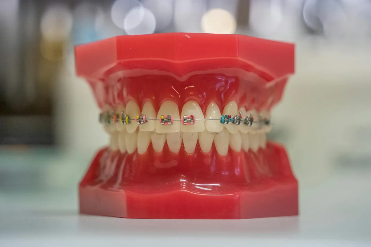 ISEE, CURSOS ONLINE- Curso en Diseño Digital de Prótesis Dentales