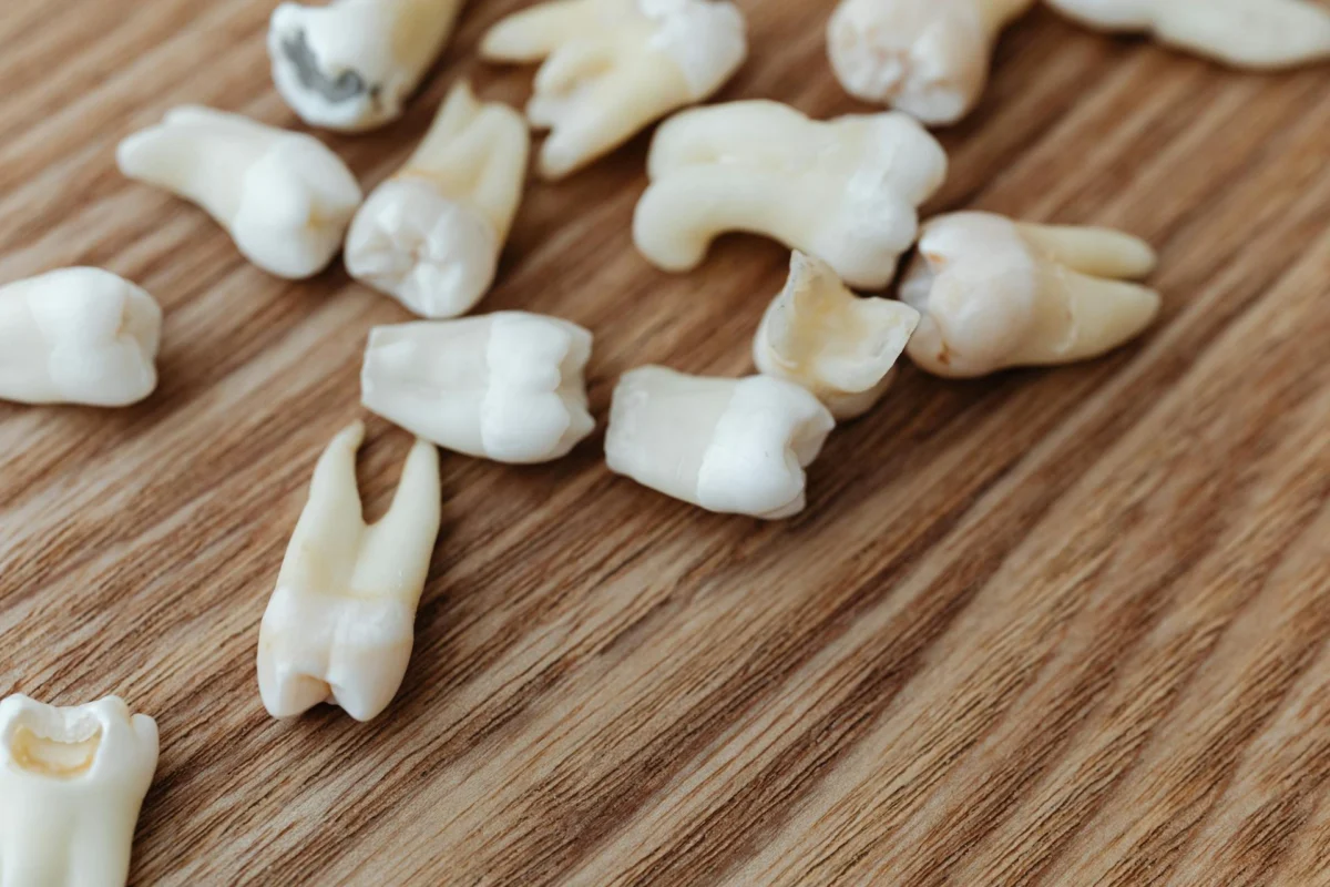 ISEE, CURSOS ONLINE- Curso en Prevención de Caries y Fluoración