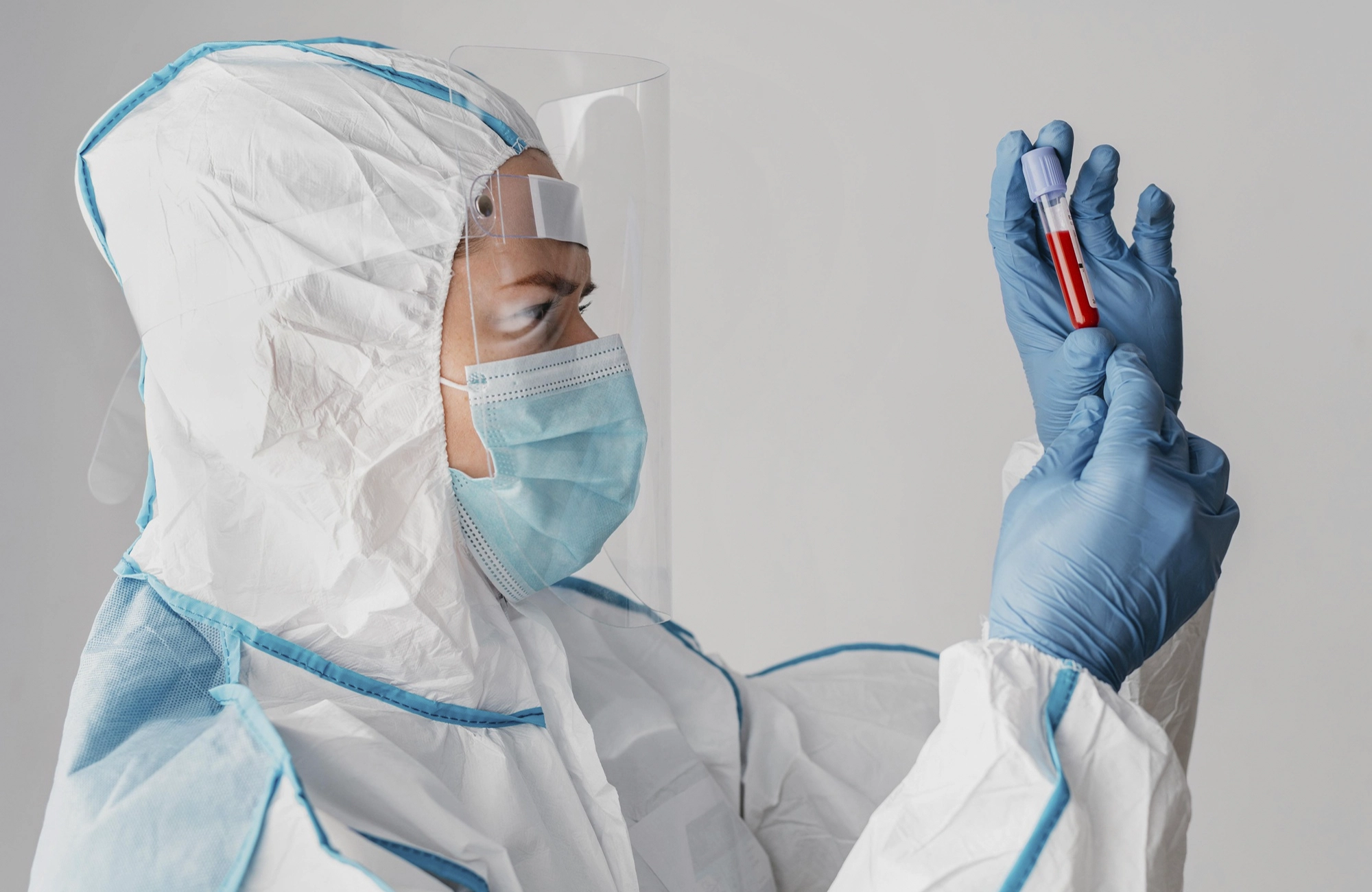 ISEE, CURSOS ONLINE- Diplomado en Epidemiología