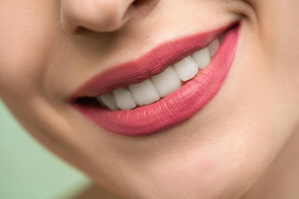 ISEE, CURSOS ONLINE- Diplomado en Técnicas Avanzadas de Blanqueamiento Dental