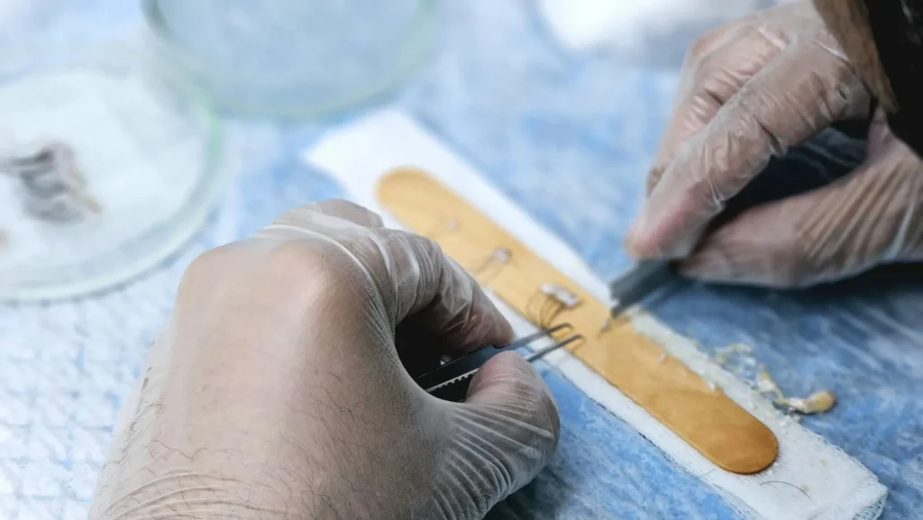 Diplomado en Transplante Capilar