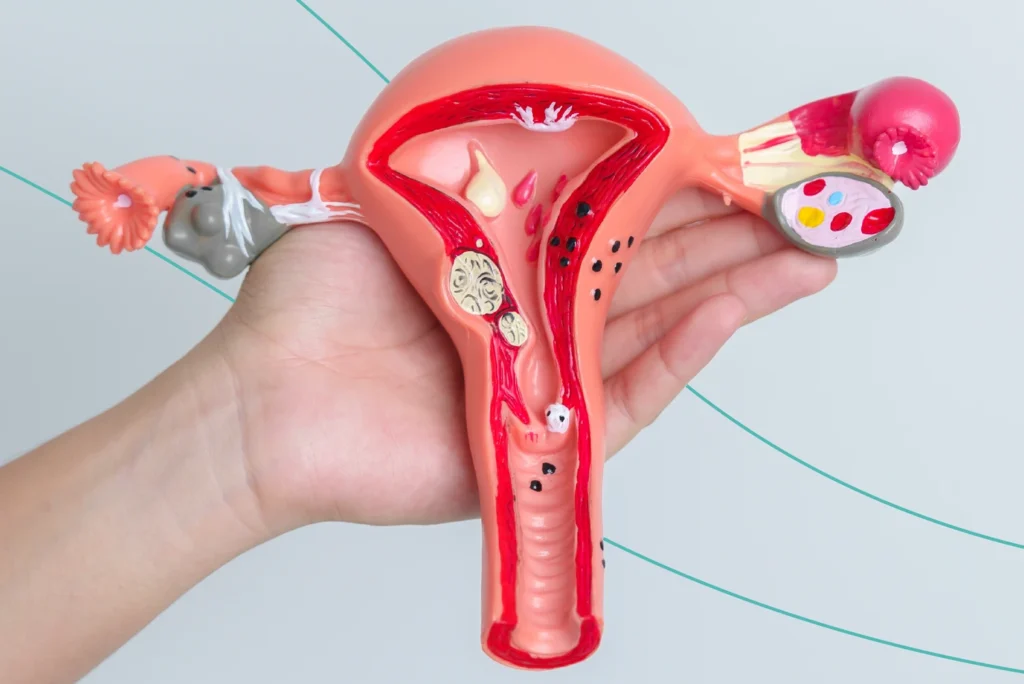 Curso en Ginecología Oncológica 3