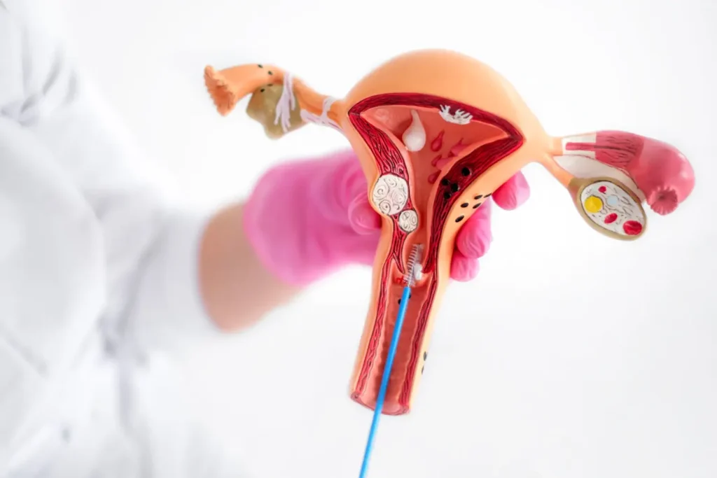 Diplomado de Semiología Ginecológica 3