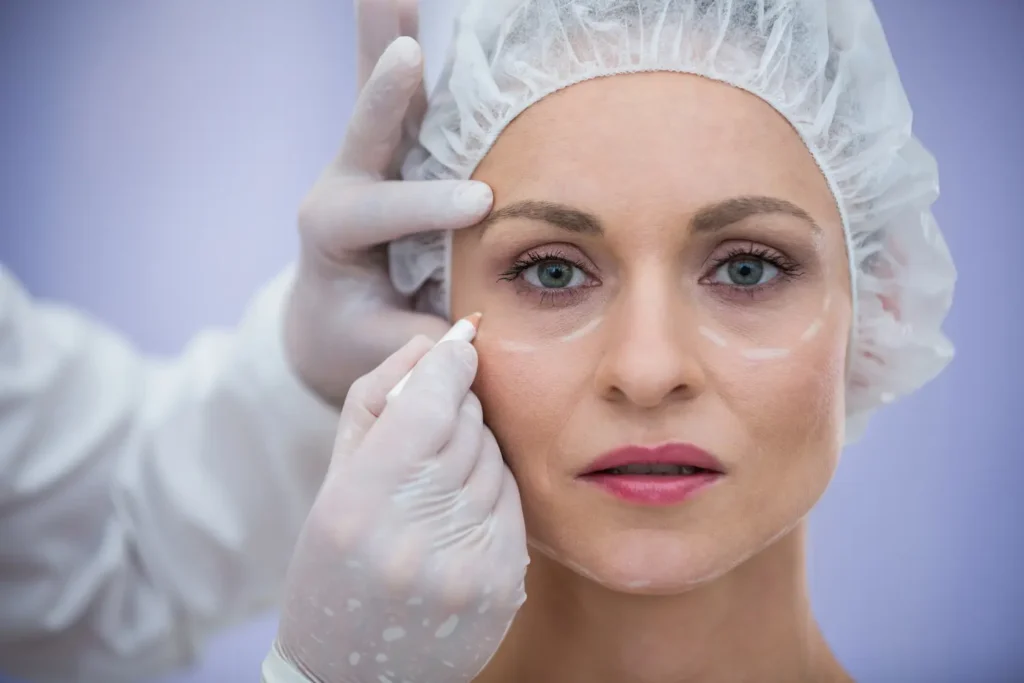 Máster en Blefaroplastia y Rejuvenecimiento Periocular Avanzado 3