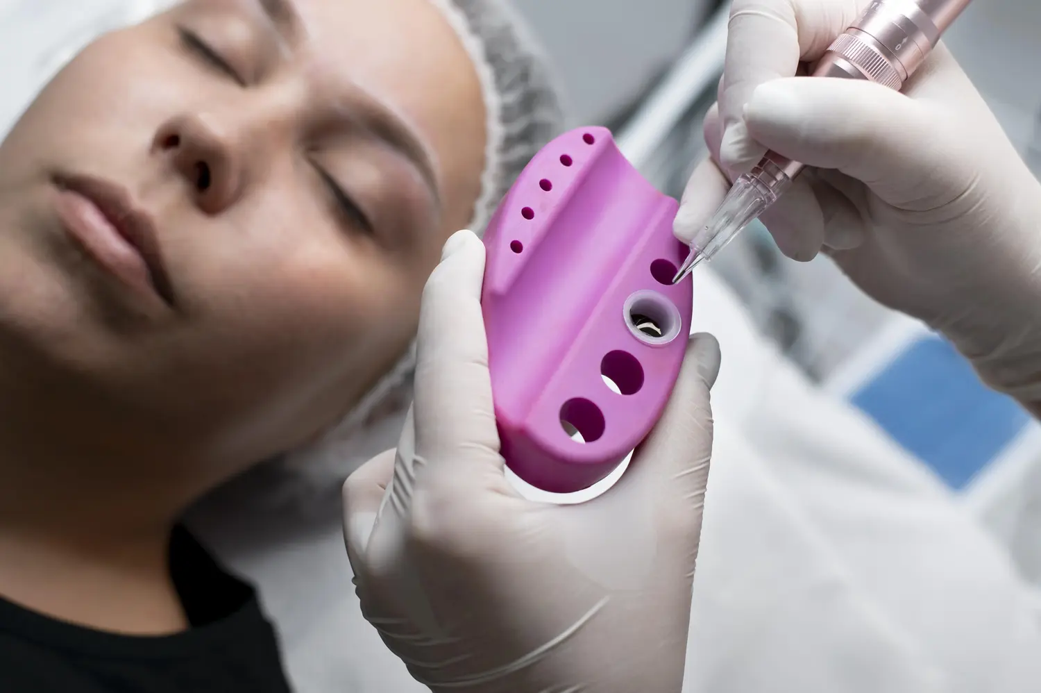 Máster en Láser Dermatológico y Fototerapia Seguridad y Casos 2