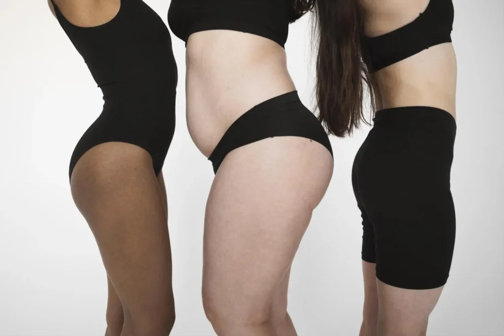 Máster en Lipotransferencia y Gluteoplastia 1