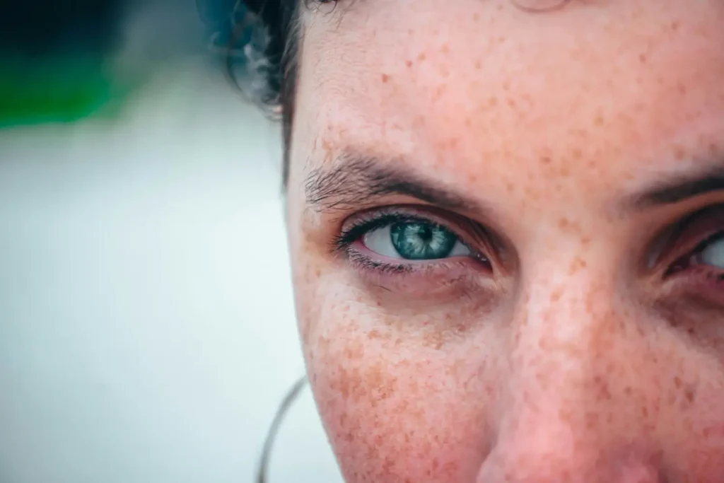 Máster en Cosmética para Hiperpigmentación y Melasma Máster en Cosmética para Hiperpigmentación y Melasma 1