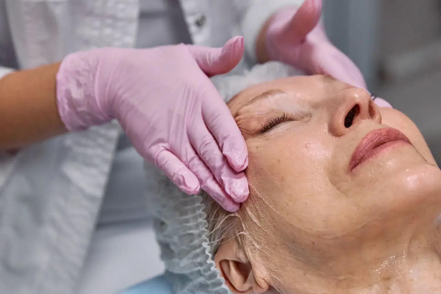 Máster en Enfermería en Peelings, Microneedling y Procedimientos Dermoestéticos 2