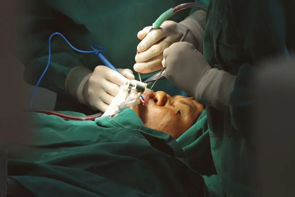 Máster en Soporte en Cirugía Facial TCAE1