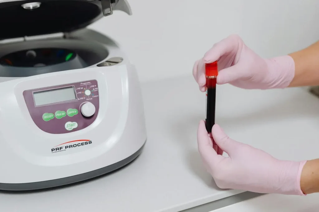 Máster en Enfermería en Medicina Regenerativa Estética PRP y Protocolos Máster en Enfermería en Medicina Regenerativa Estética PRP y Protocolos 1