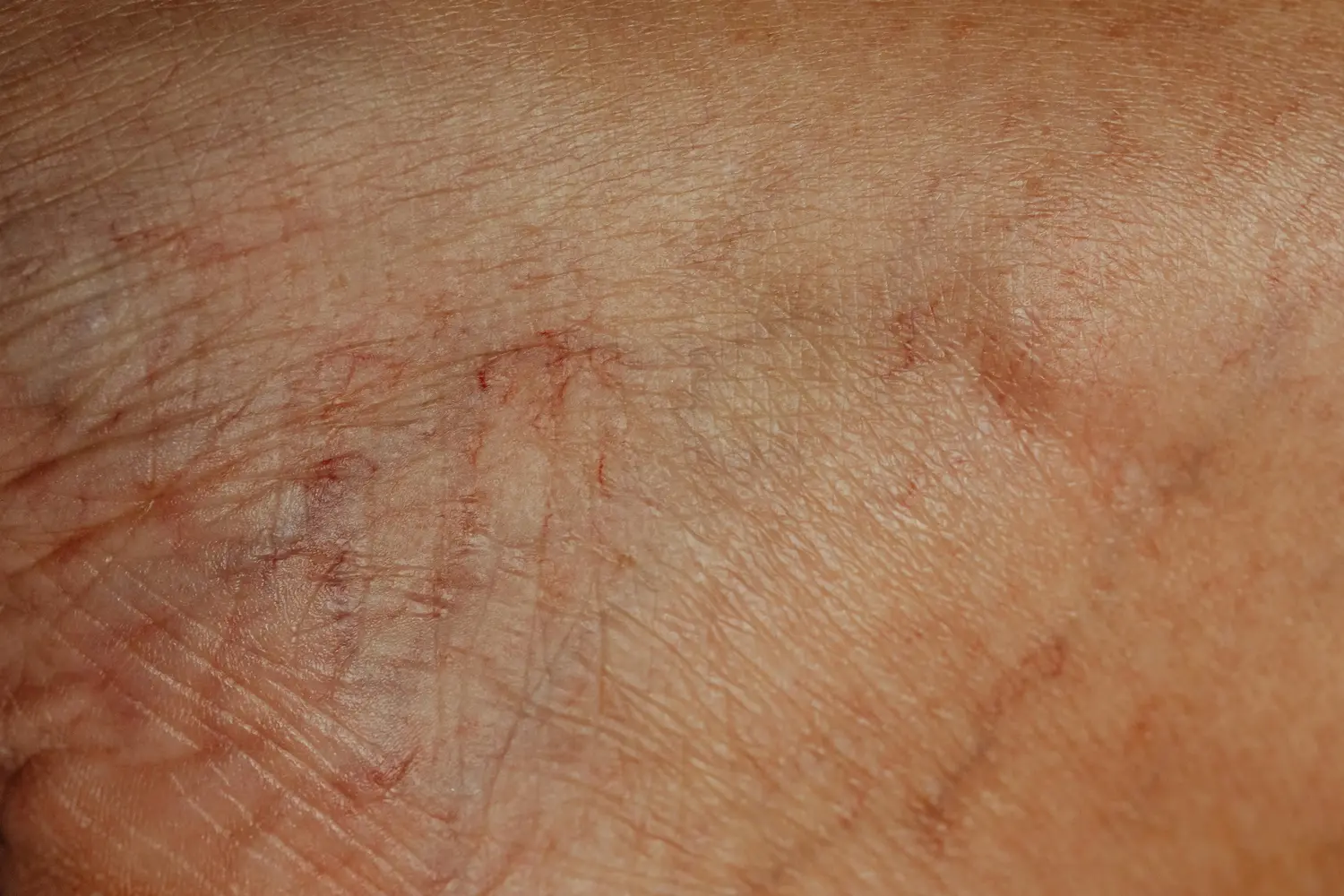 Máster en Evaluación de Seguridad Cosmética y Dermatitis por Cosméticos 2