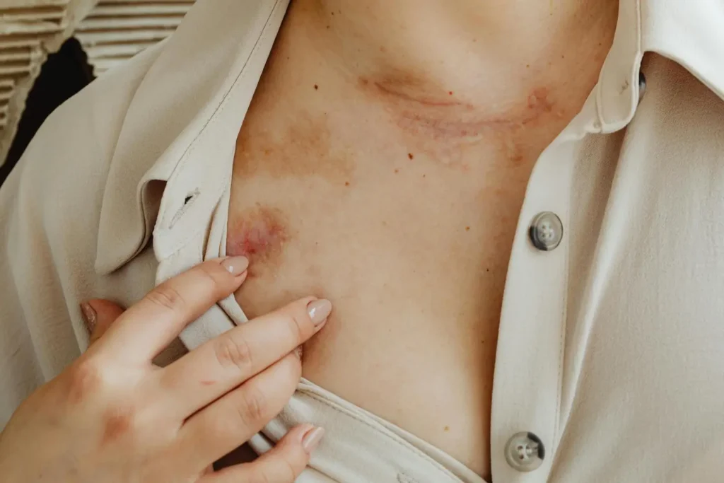 Máster en Diagnóstico Dermatológico y Triaje de Lesiones Cutáneas 3