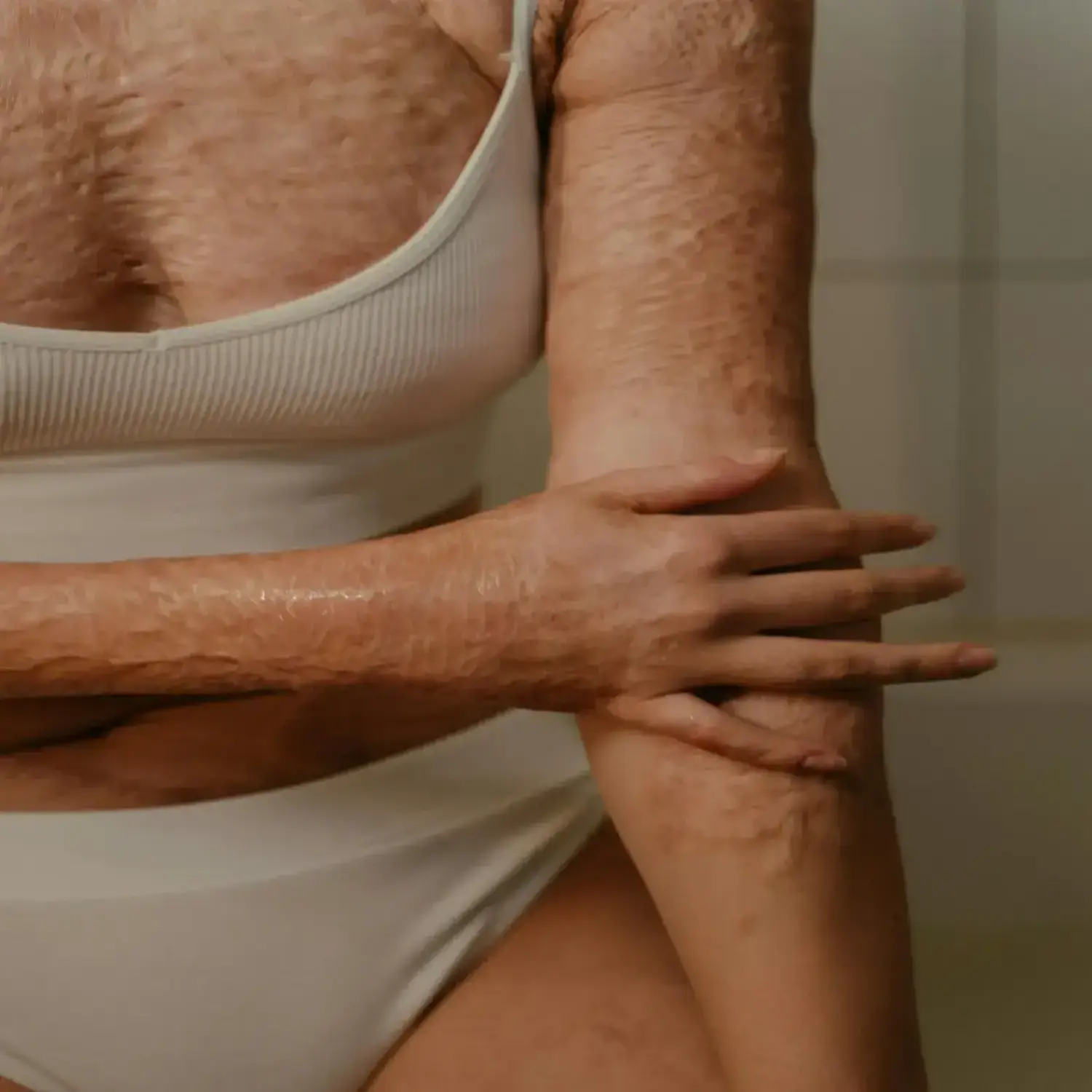 Máster en Diagnóstico Dermatológico y Triaje de Lesiones Cutáneas 2