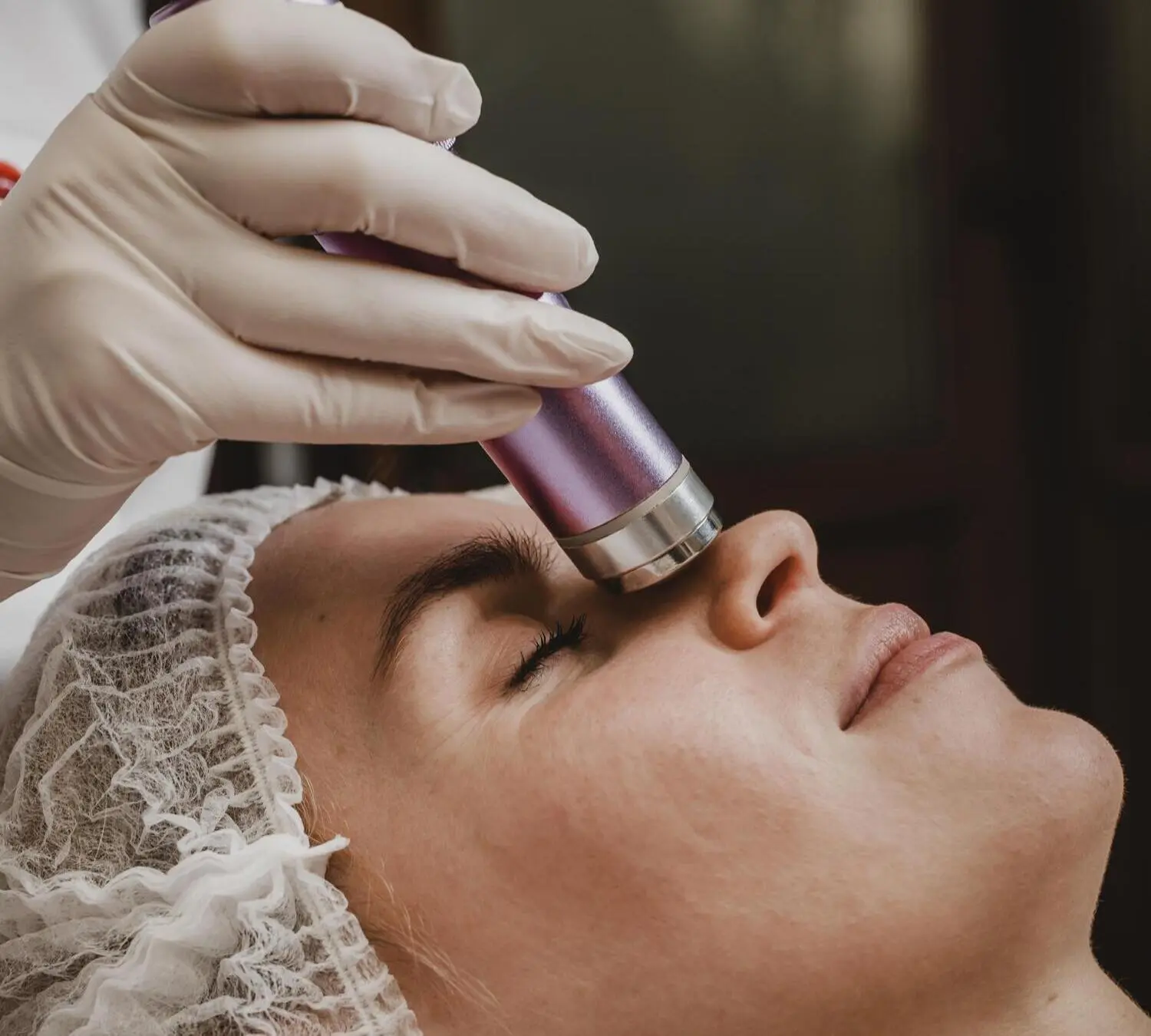 Máster en Láser Dermatológico para Patología y Estética Vasculares y Pigmento 2