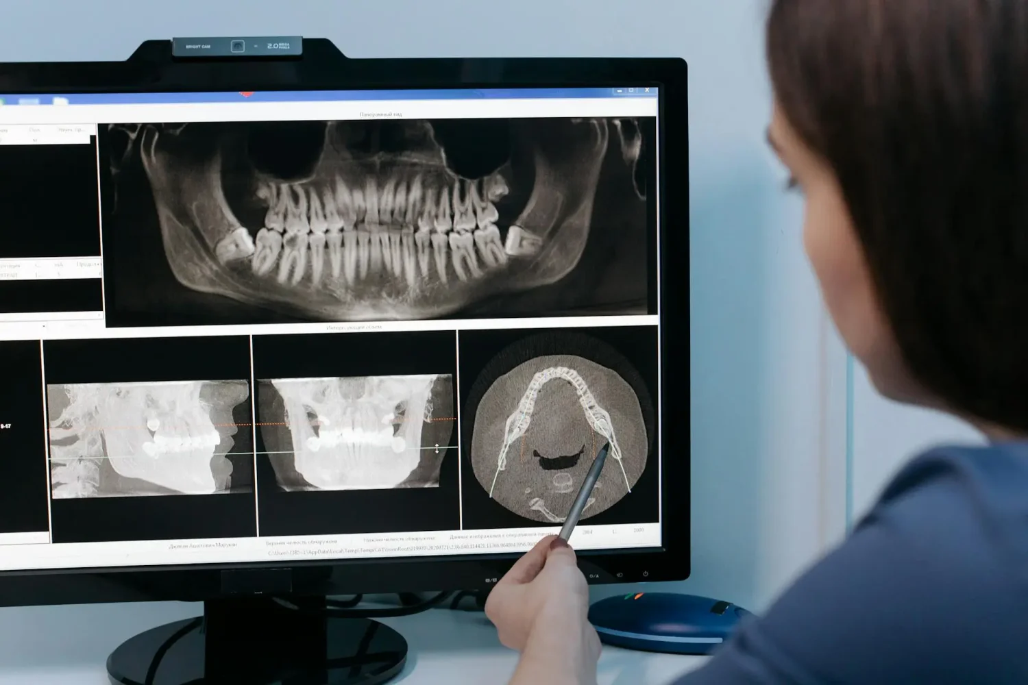 ISEE, CURSOS ONLINE- Diplomado en Fotografía Odontológica