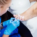 Diplomado en podología estética