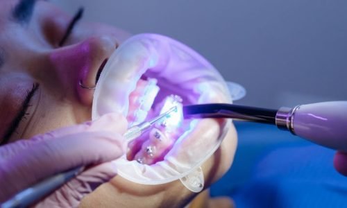 Máster en Rehabilitación Oral Odontología Estética Avanzada y Nuevas Tecnologías