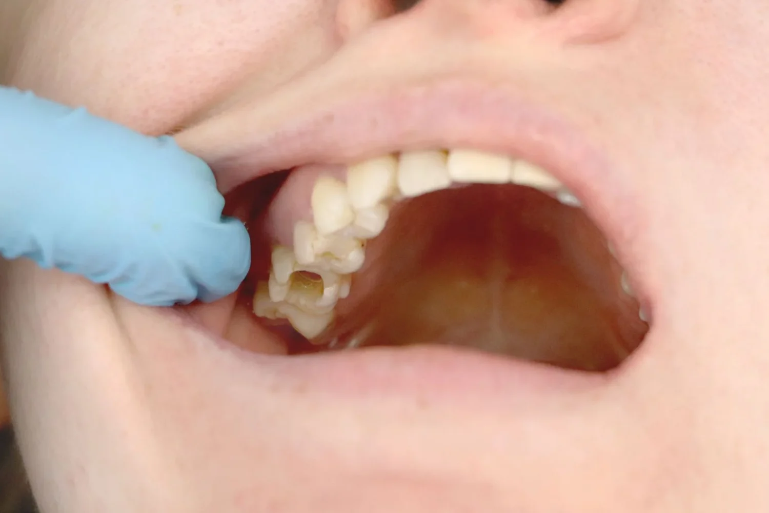 ISEIE-maestria en odontologia estetica y restauradora