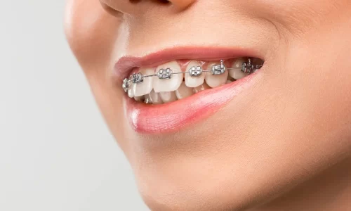 ISEIE-precio master ortodoncia