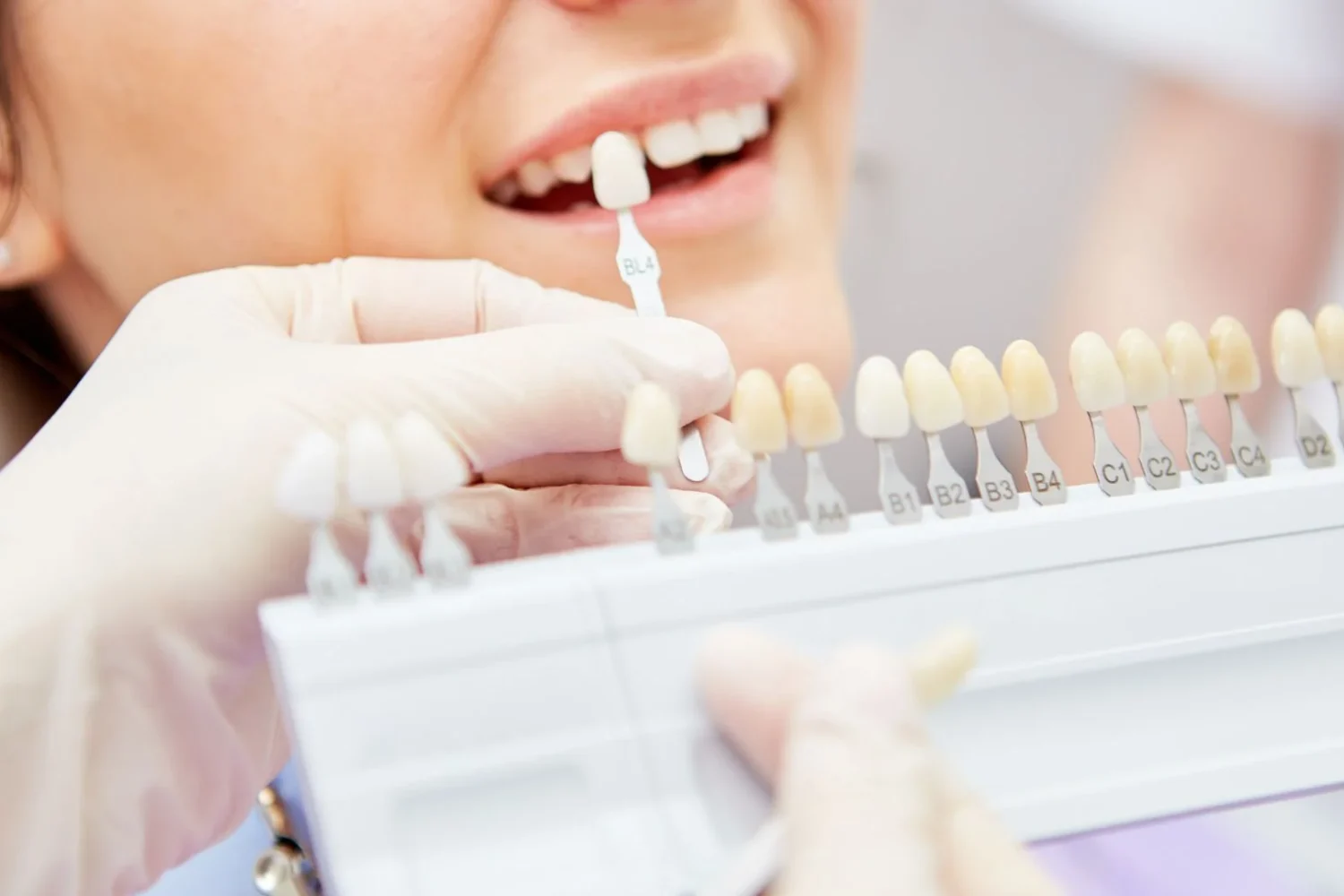 ISEIE-rehabilitación oral