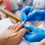 Máster Cirugía de Mínima Incisión para Podólogos 2