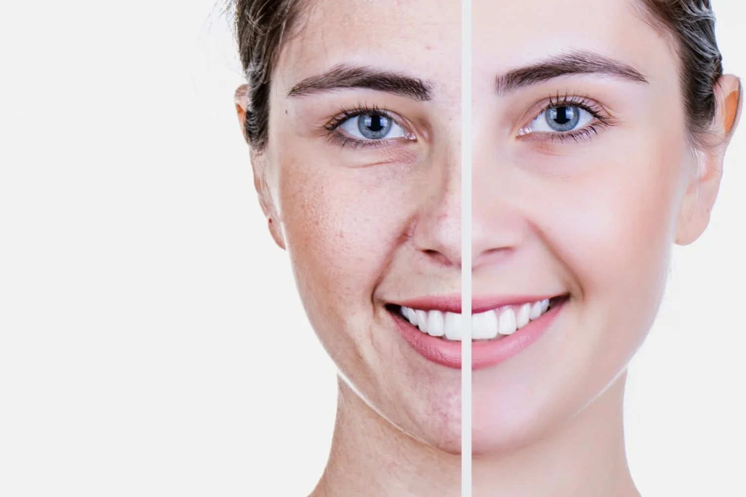 Master en Dermatología y Antiaging