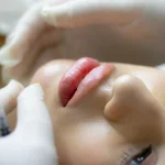 ISEE, CURSOS ONLINE- Máster en Estética Digital y Diseño de Sonrisas