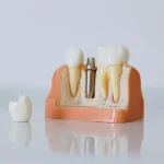 ISEE, CURSOS ONLINE- Máster en Odontología Regenerativa