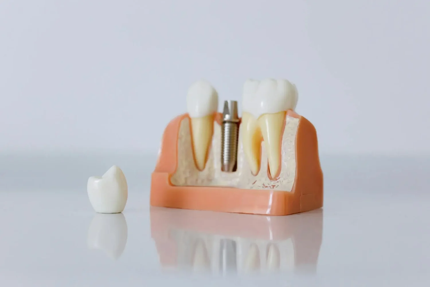 ISEE, CURSOS ONLINE- Máster en Odontología Regenerativa
