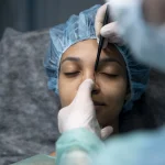 Máster en Rinoplastia Avanzada Funcional y Estética 1
