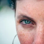 Máster en Cosmética para Hiperpigmentación y Melasma 1