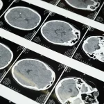 Máster en Radiología y Técnicas de Imagen para el Diagnóstico Clínico 1