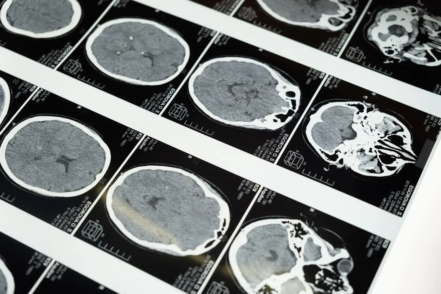 Máster en Radiología y Técnicas de Imagen para el Diagnóstico Clínico 1