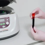Máster en Enfermería en Medicina Regenerativa Estética PRP y Protocolos 1