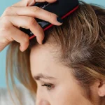 Máster en Patología del Cabello y Cuero Cabelludo Dermato-Tricología 1