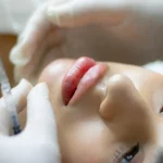 Máster en Enfermería en Medicina Estética Integral 1